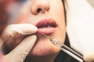 Woman receiving injection in her lip