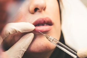 Woman receiving an injection in her lip