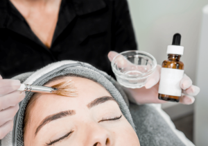 Treatment review: chemical peels