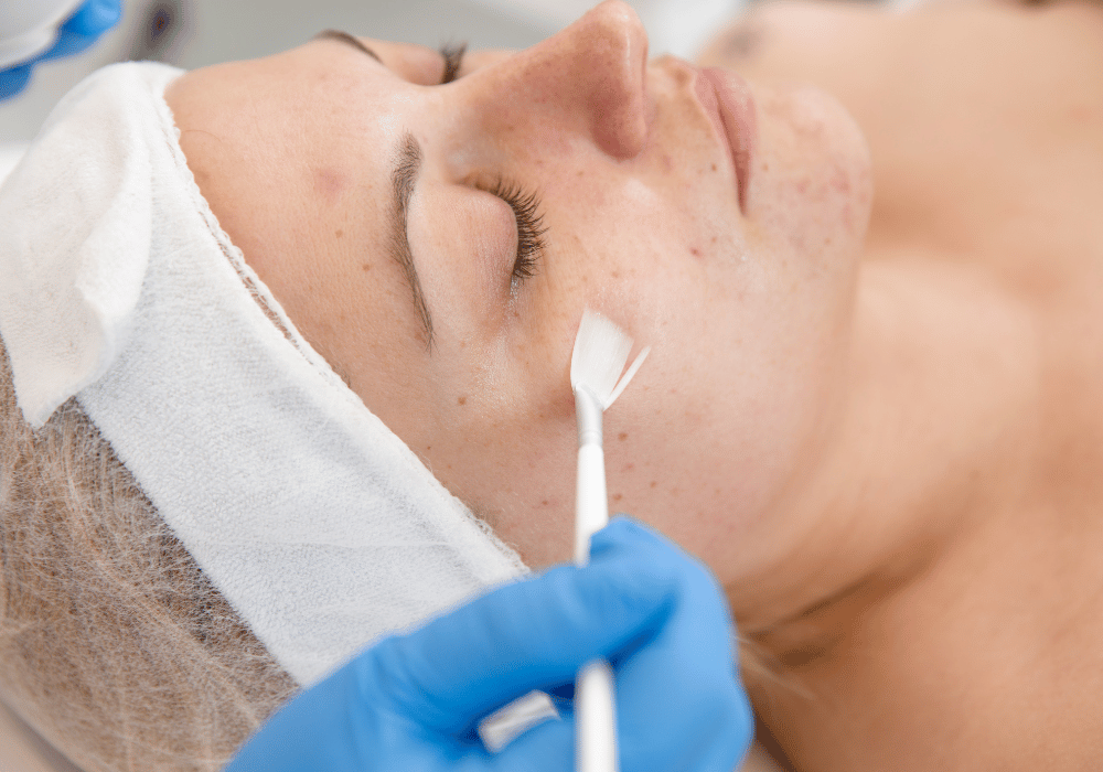Treatment review: chemical peels