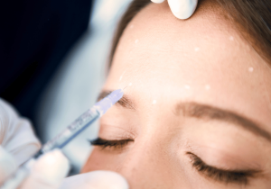 Botox: Comprehensive Guide to Its Uses, Longevity, and Care