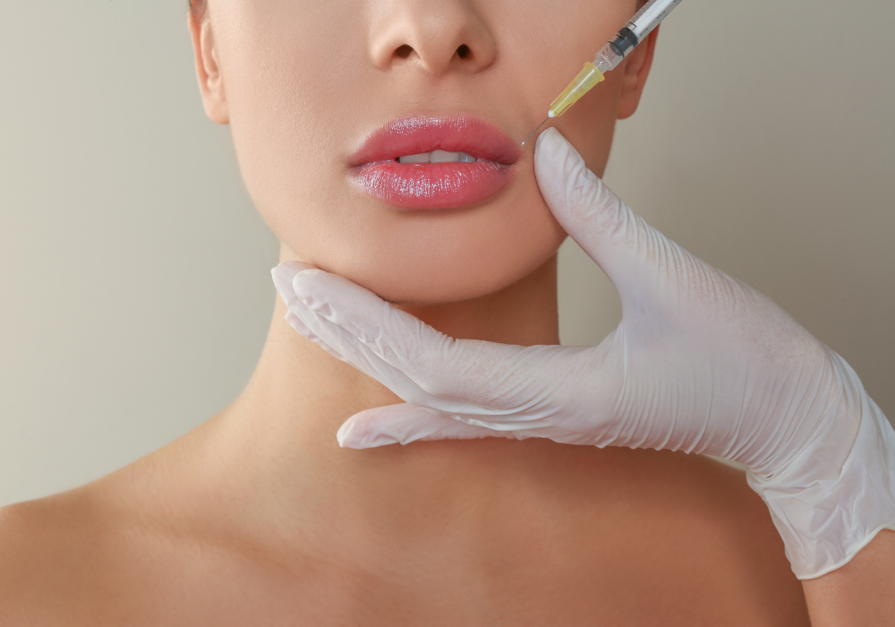 Enhancing Lip Volume with Dermal Fillers